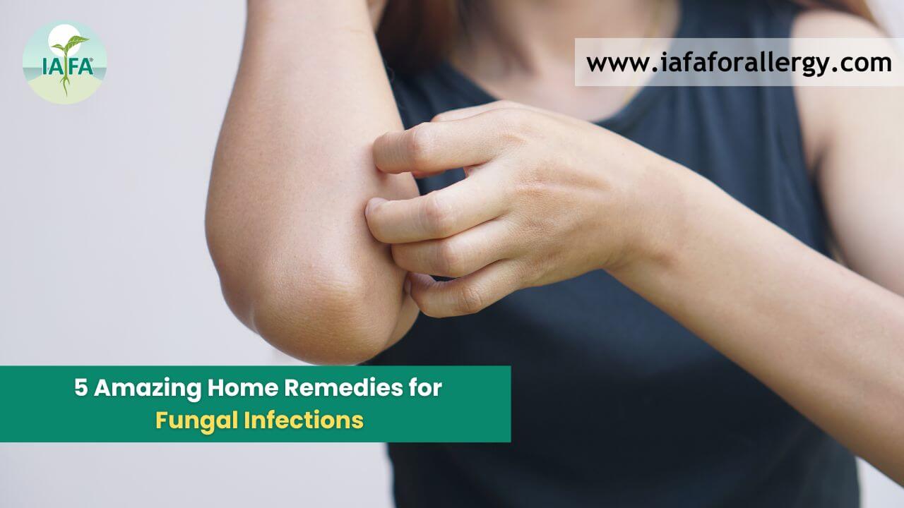 Home Remedies for Fungal Infections