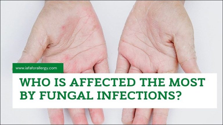 who-is-affected-the-most-by-fungal-infections