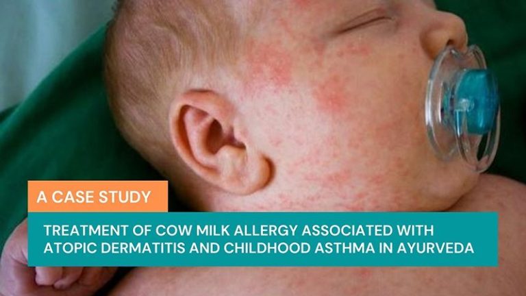 treatment-of-cow-milk-allergy-associated-with-atopic-dermatitis-and