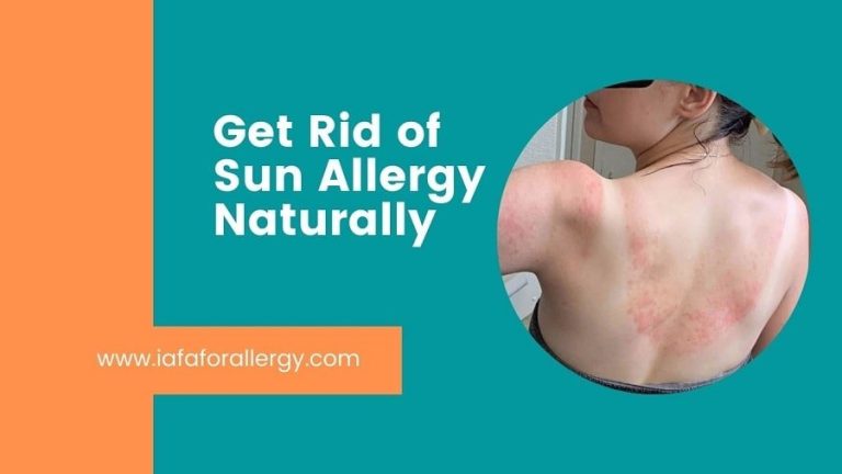 How Do You Get Rid Of Sun Allergy Naturally