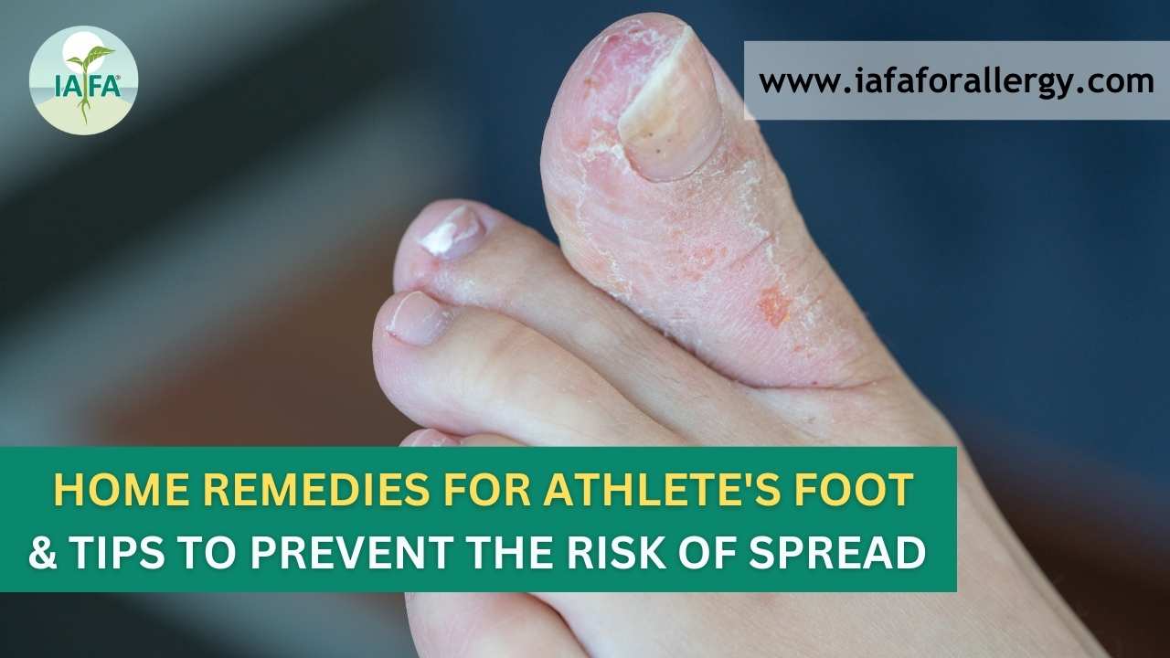 Home remedies for Athlete's foot