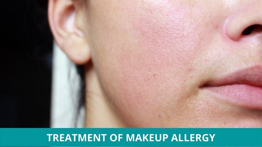 allergies to eye makeup
