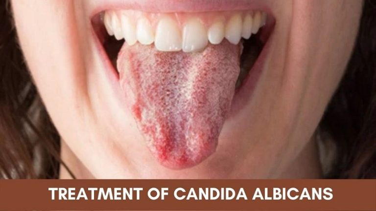 What Is Candida Albicans And How To Treat It 