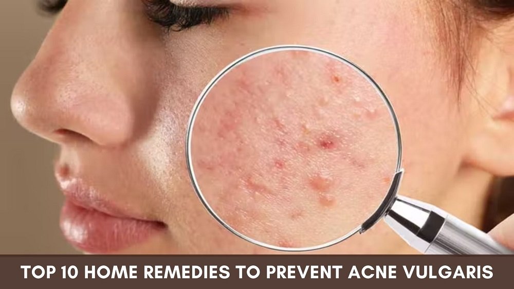 indian home remedy for acne