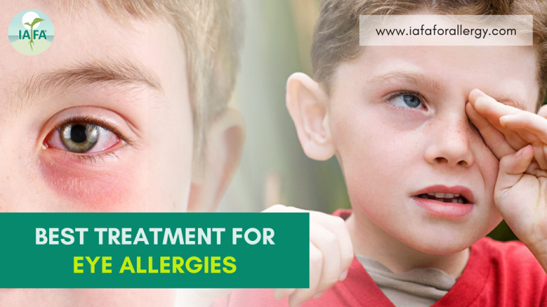 What Is The Best Treatment For Eye Allergies 