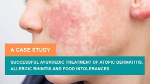 Successful Ayurvedic Treatment of Atopic Dermatitis, Allergic Rhinitis ...