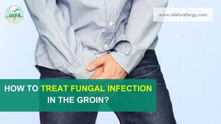 how-to-treat-fungal-infection-in-the-groin