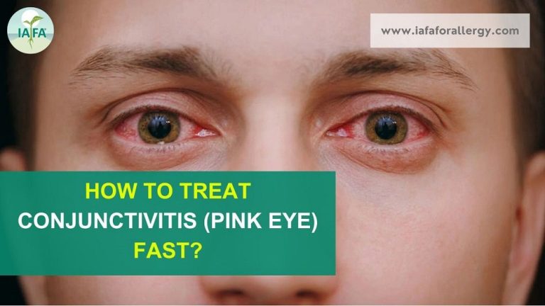 How To Treat Conjunctivitis Pink Eye Fast 