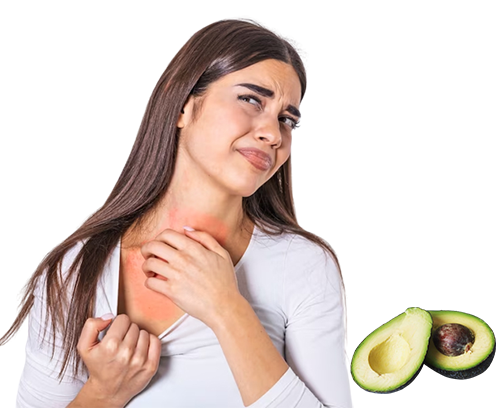 Manage Avocado Allergy