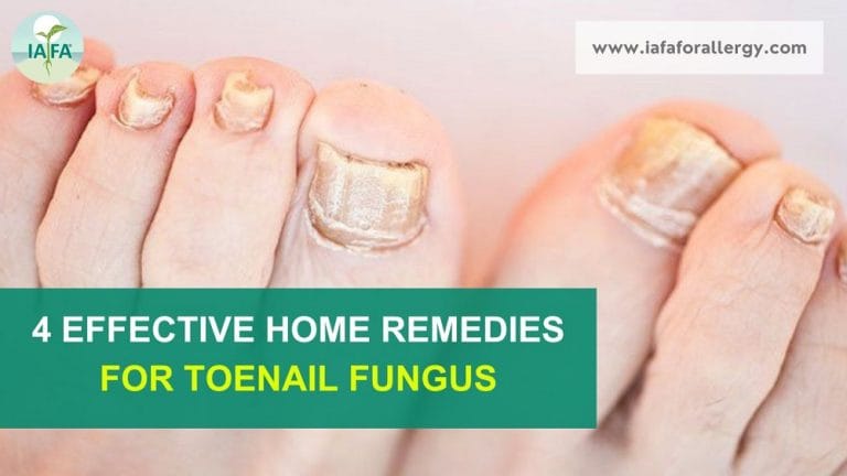 Top 10 Home Remedies to Prevent Fungal Groin Infection