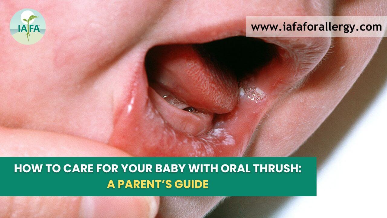 How to Care for Your Baby with Oral Thrush: A Parent’s Guide