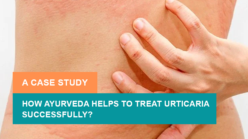 How Ayurveda Helps to Treat Urticaria With Angioedema Successfully? A Case Study