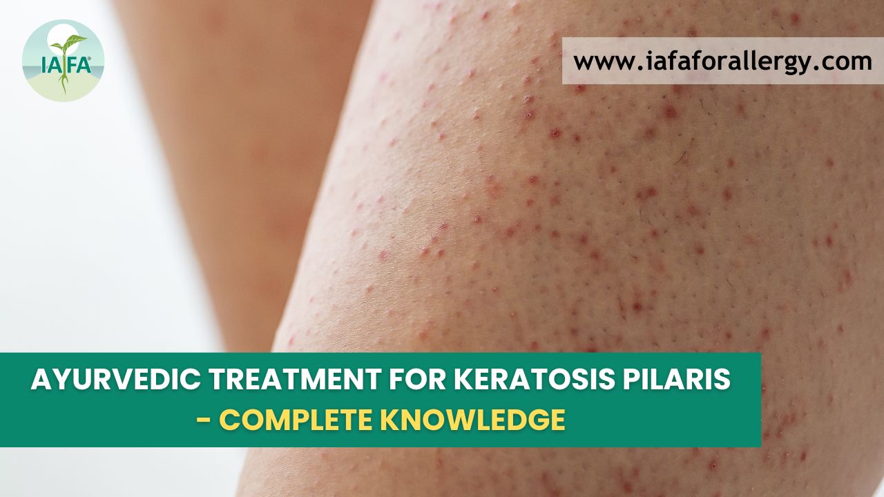 Ayurvedic Treatment for Keratosis Pilaris