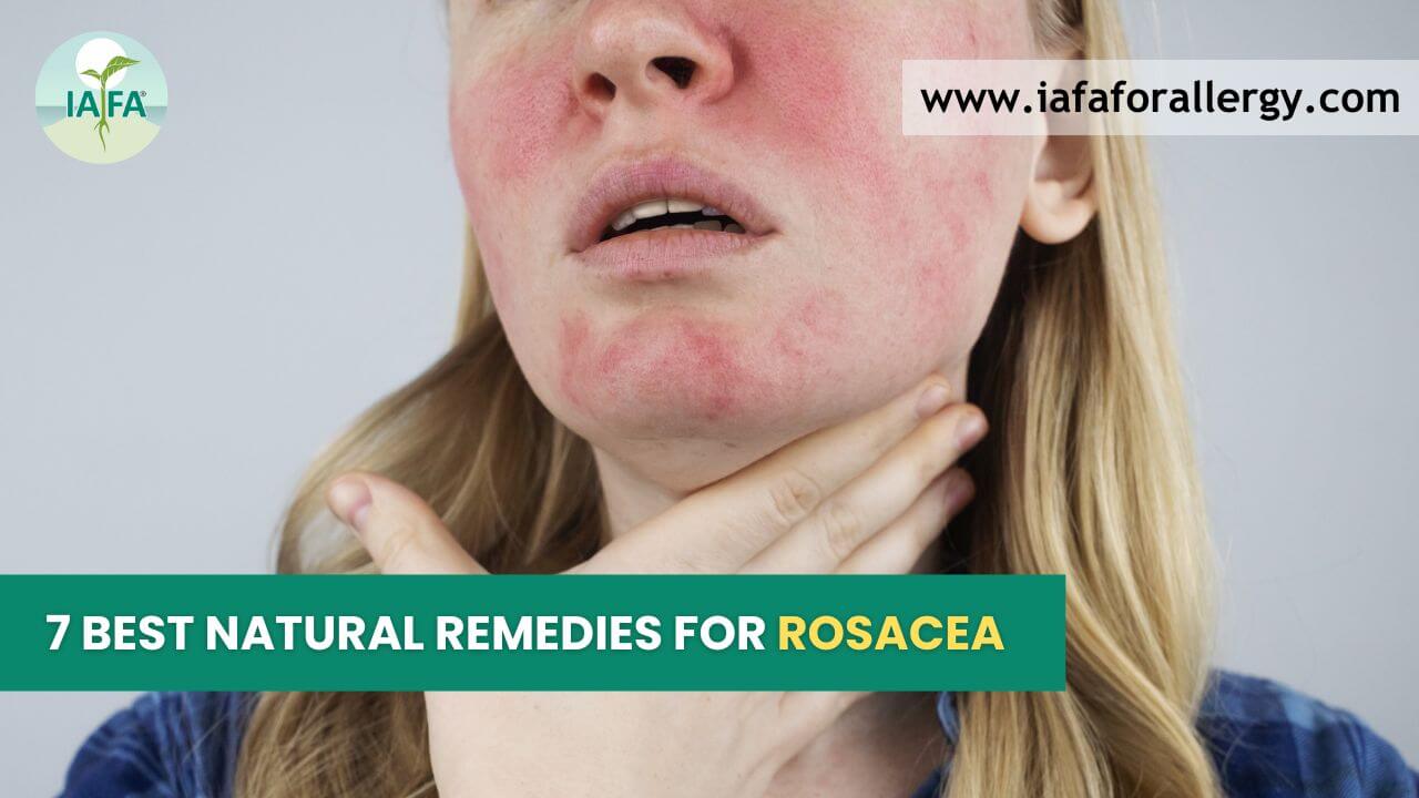 Natural Remedies for Rosacea